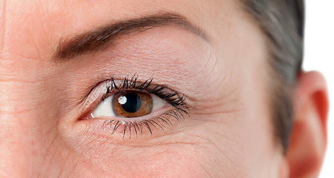 Ptosis palpebral (Párpado Caído). Mejora tono y musculatura del párpado